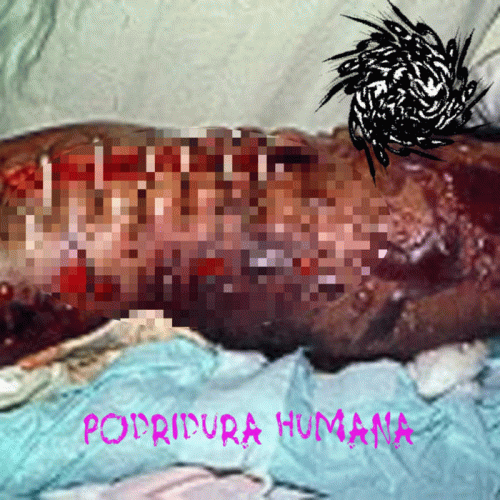 Autozoofilia Antropofagolagnica : Podridura Humana